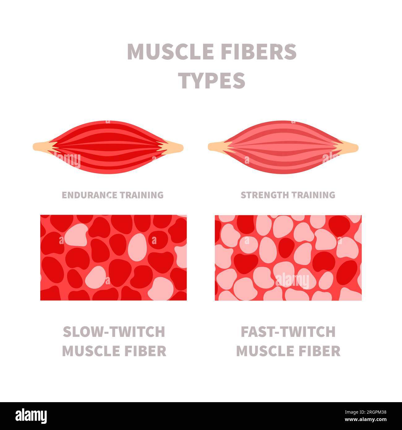 Image of Muscle Fibers - Slow vs Fast Twitch